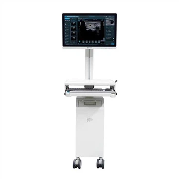 Diagnóis Ultrasonography Chliste
